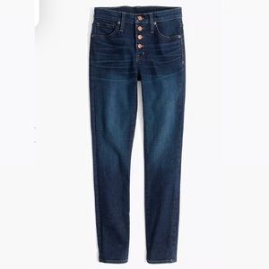 Madewell 9” High Rise Skinny Button Fly Jeans